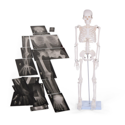 Half Scale Skeleton and X-rays Collection