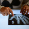 Human Models and X-Rays Collection